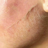 Dermaplaner Razor Dusty