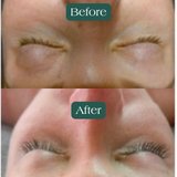 Eyelash Growth Serum